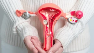 Woman holding anatomically correct near pelvis with clear PCOS symptoms